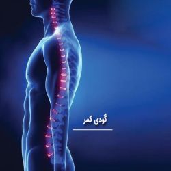 برای گودی کمر کدام تشک مناسب است؟
